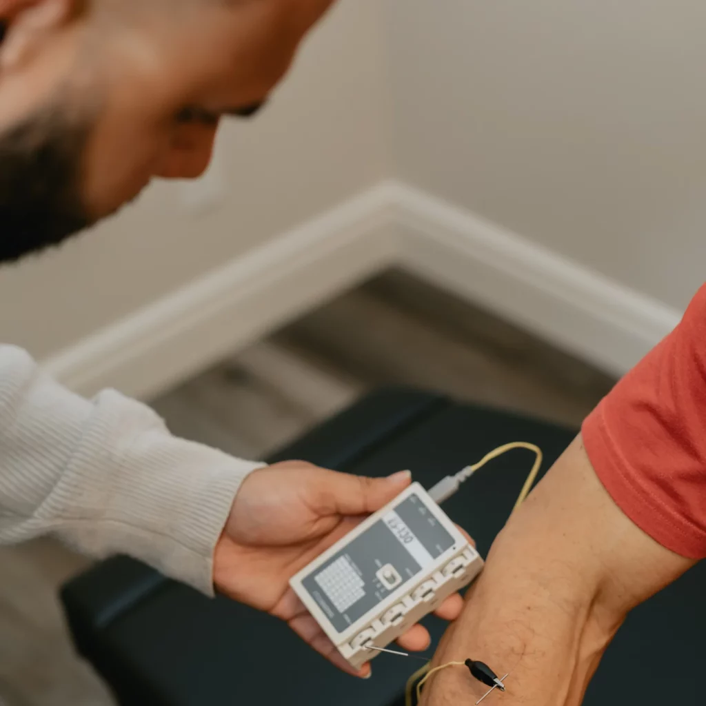 Acupuncture-London-Ontario-Reset-Chiropractic